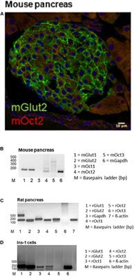 Expression and Function of Organic Cation Transporter 2 in Pancreas